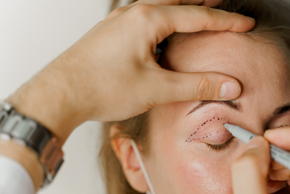 Why Should You Consider Eyelid Rejuvenation